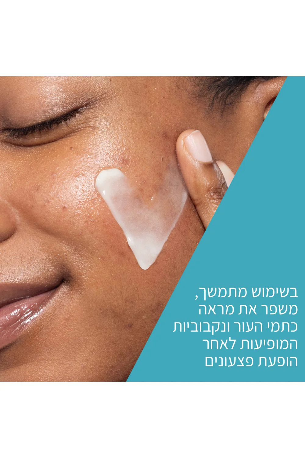 תמונת מוצר 4